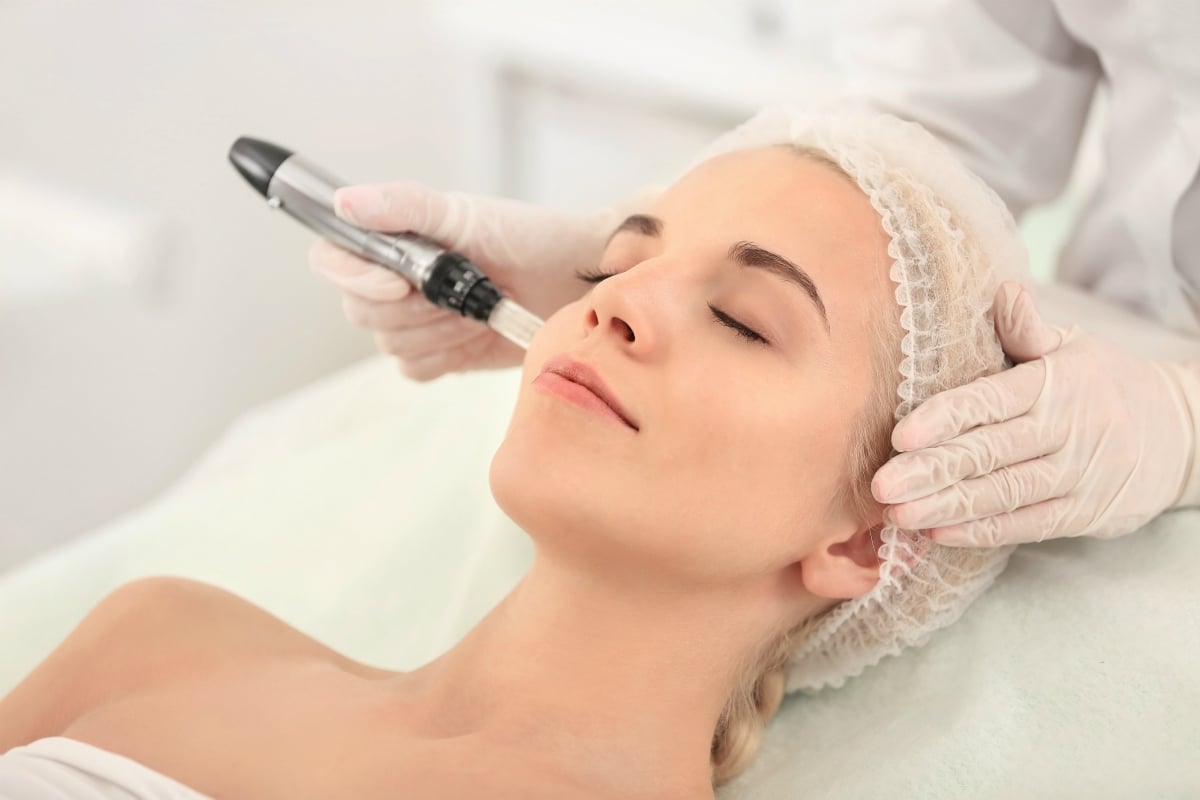 MICRONEEDLING MEZOTERAPIA DERMAPEN