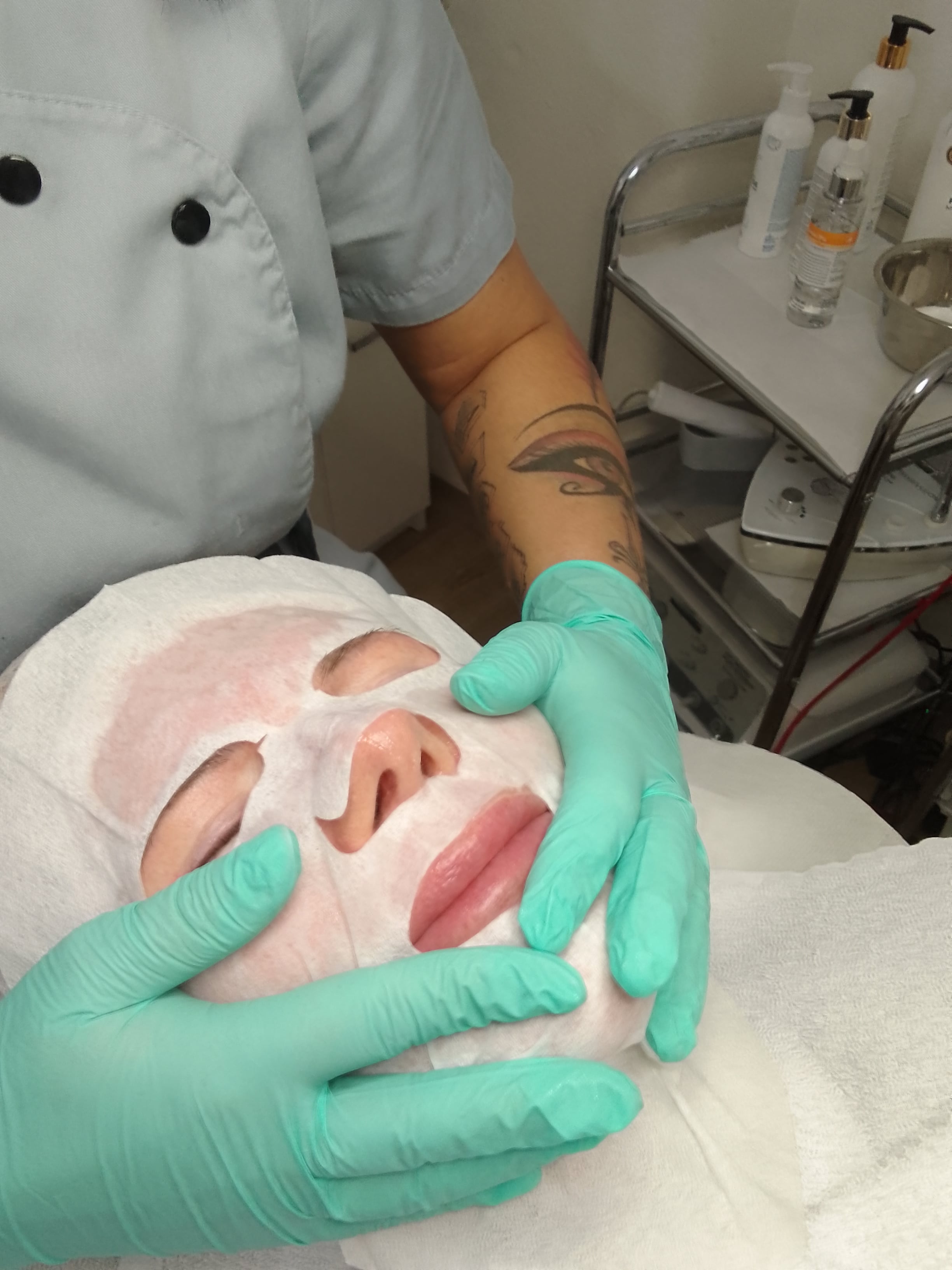 KARBOXY TERAPIA